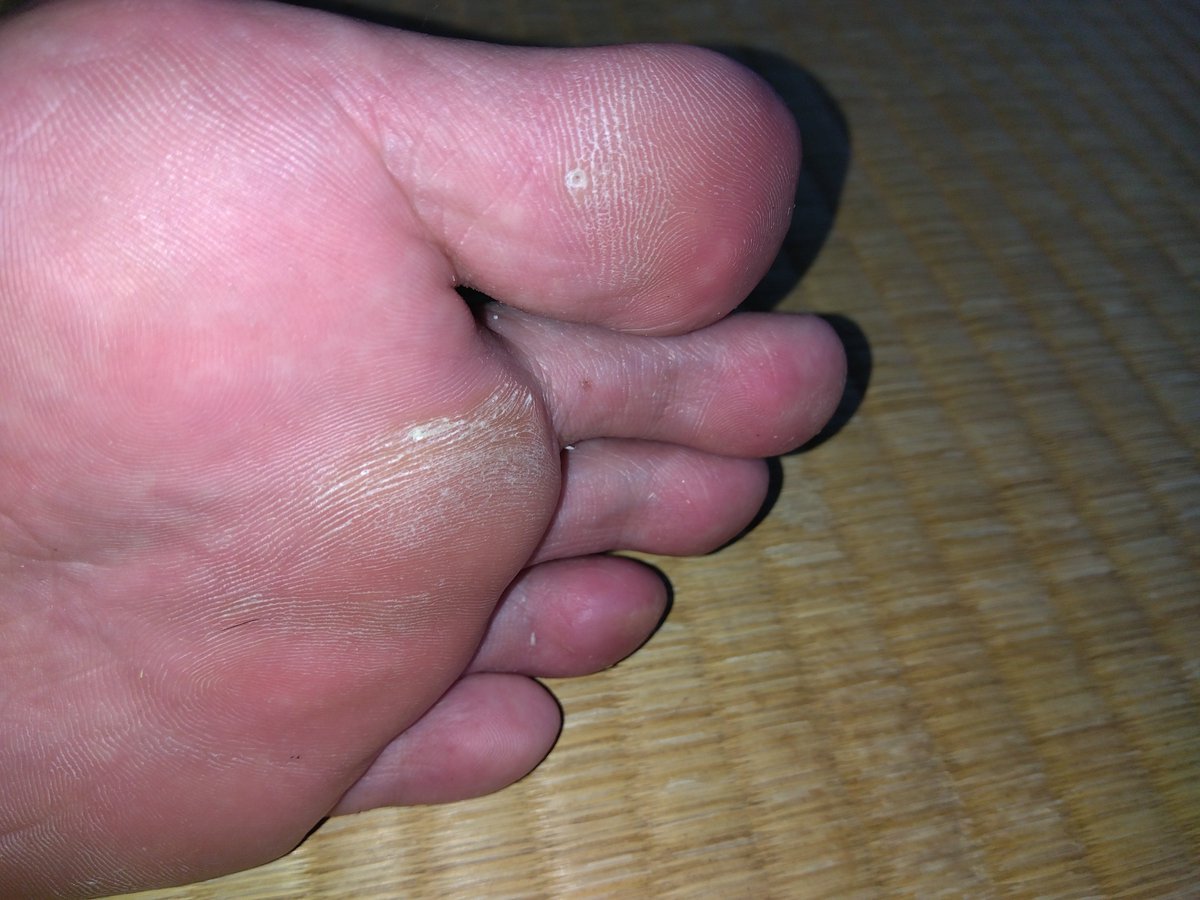 Xo4n3's tweet photo. 買い物���ら帰ってきた直後のホカホカ足裏👣
親指の角質と指の股のじっとり感がたまらんw
​#男の足裏 #足裏 #素足 #蒸れ足 #扁平足 #ゲイ #GayFeet #MaleFeet https://t.co/h9HxCoz1bT