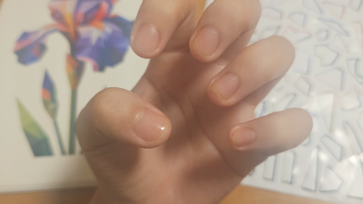 lty_kd's tweet photo. 先々週から爪伸ばしチャレンジしてる
ストレスない環境だからかなり順調
えぐれてた部分のハイポキニウムが育ってきてる https://t.co/iHexRJ6Mrh