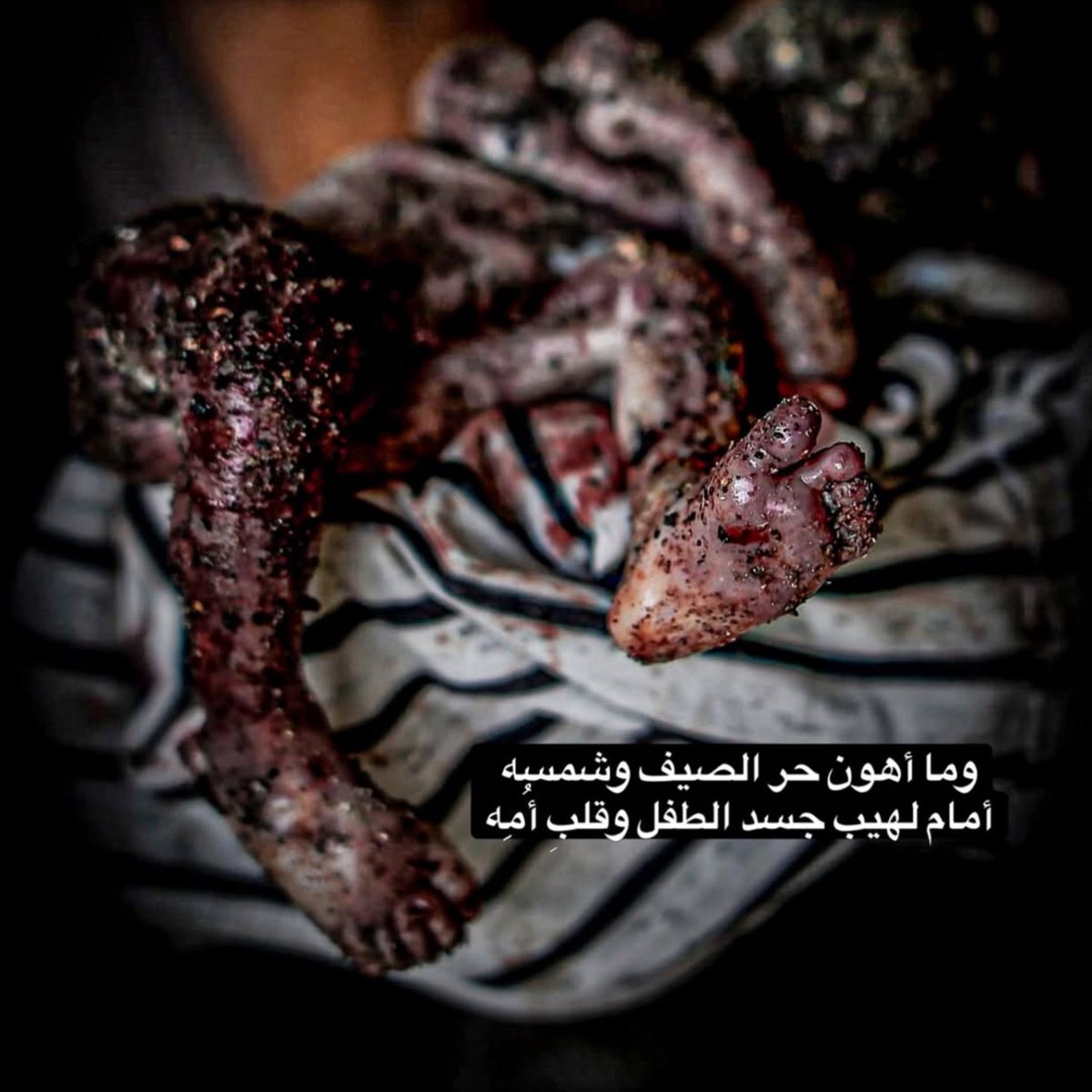 gazanotice's tweet photo. 🚨BREAKING: ISRAEL KILLED AN UNBORN BABY IN GAZA.