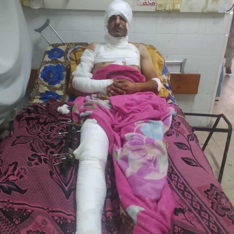 AlbrdwylAb58163's tweet photo. I never asked for help when I looked like this in the photo. I paid for my own treatment and relied on no one But today I have nothing left I lost my home my savings and everything I owned. I can no longer rebuild my life alone If you can helpor even just share my storyyou 👇 https://t.co/2BFFcANpN7