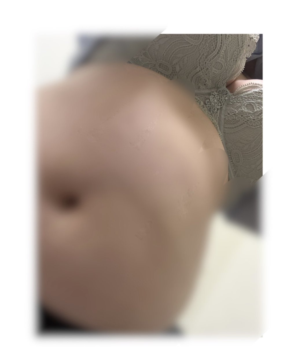 sub11999977's tweet photo. 大肚肚快消失。 https://t.co/b7qpUyxh7n