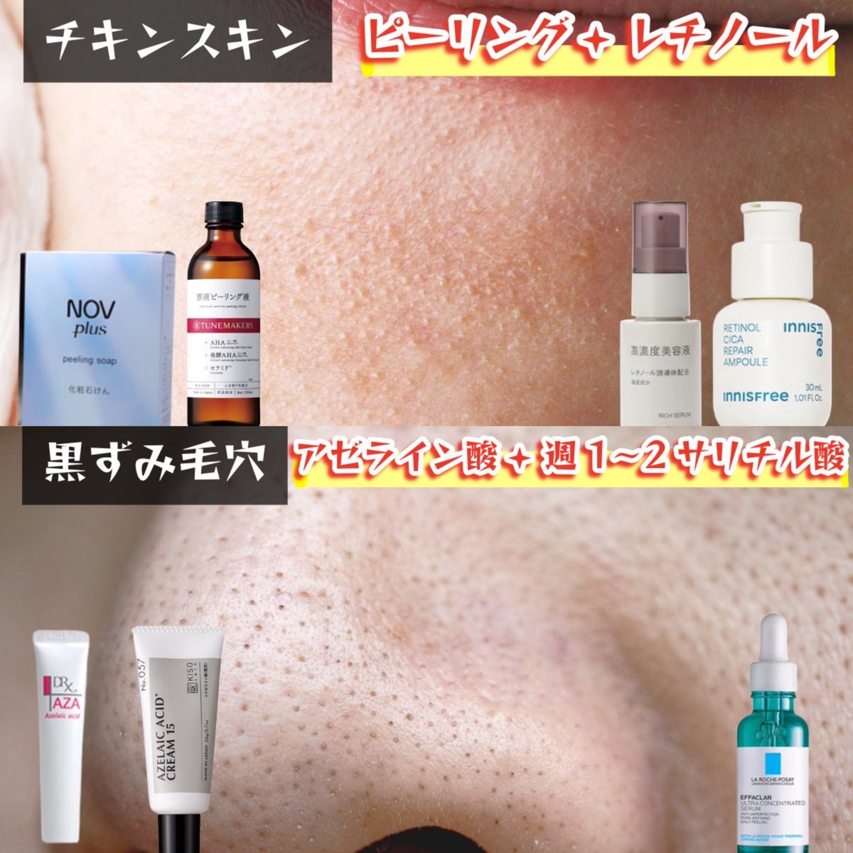 melt__in's tweet photo. 毛穴対策はこれ使え‼️‼️‼️
信用できるスキンケアだけでまとめた‼️‼️もちろんステマなし

角栓詰まり
└レチノール・酵素洗顔

開き毛穴
└ビタミンC ・グリシルグリシン

チキンスキン
└ピーリング・レチノール(併用×)

黒ずみ毛穴
└アゼライン酸・サリチル酸 https://t.co/tj3CjBnlm3