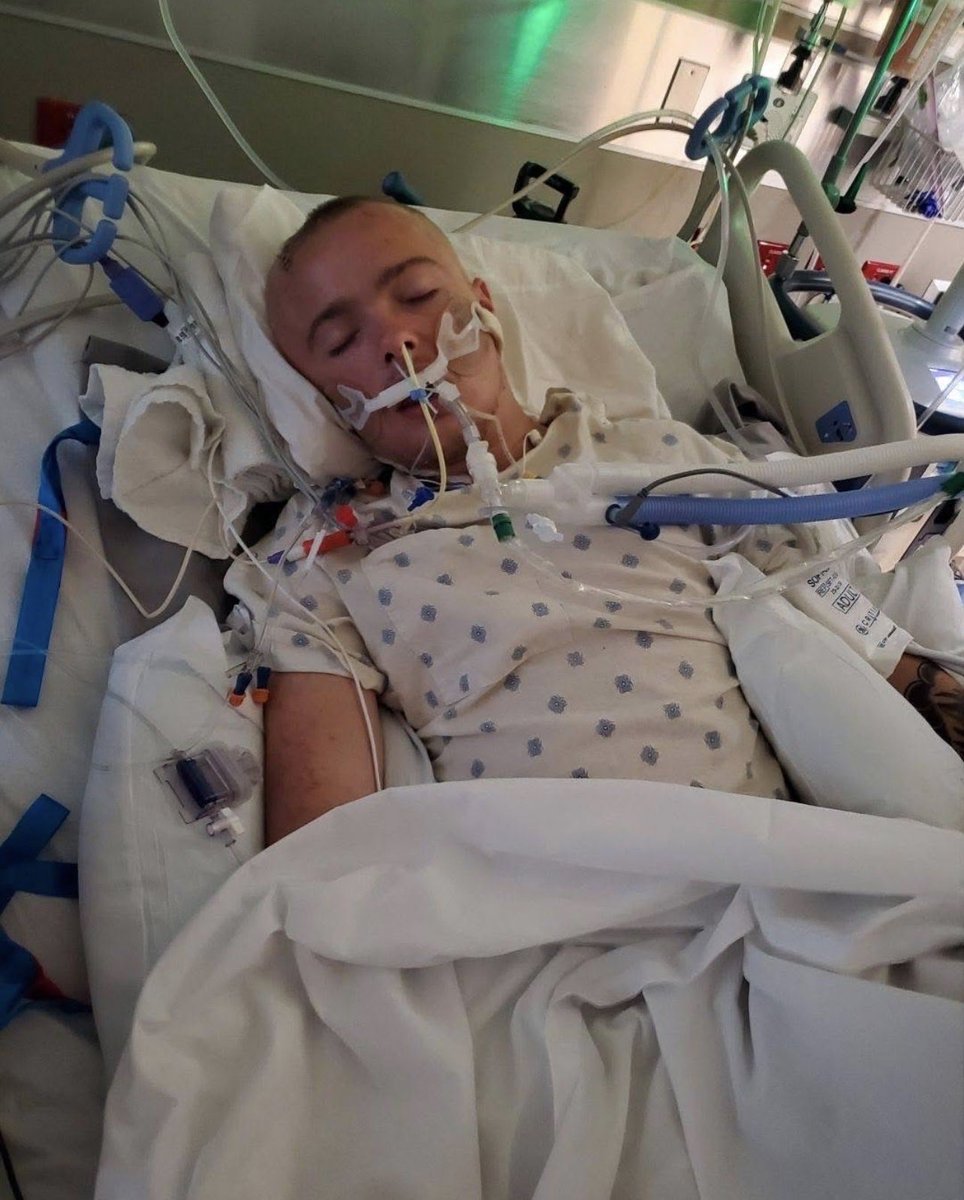 kacdnp91's tweet photo. “Why would an Honorable Scientist plead the 5th????? You can't convince me that the vaccine wasn't what killed Brandon. He was forced to get 2 of them in Job Corps. A healthy 22 year old was FORCED, he was gave the choice of his education or leaving the program. 9 months later he was dead. The blood vessels in is brain had holes all in them. All the specialists couldn't figure out what caused it. He had 6 teams of doctors, that couldnt find a reason. What I find is odd is the nurses and doctors all said they had seen this alot recently in young people. Imagine that. Now don't forget, we were shut down from talking about where it came from, treatment or concerns. We were all sitting ducks and you could never convince me that isn't what caused my son his brain bleed. I WATCHED MY SON FIGHT FOR HIS LIFE FOR 21 DAYS, 4 BRAIN SURGERIES AND THIS JERK GETS TO PLEAD THE 5TH???????? INSANE, CRUEL AND HEARTLESS. WE DESERVE ANSWERS”

(Post from mom Crystal)

‼️There is no statute of limitations for murder. Under both federal law and the laws of all 50 U.S. states.‼️