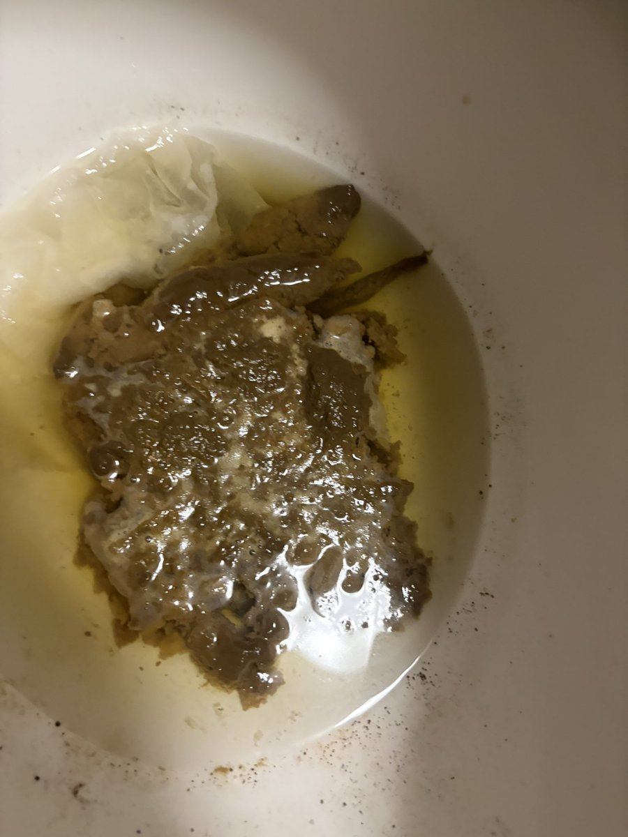 jifflypuff's tweet photo. Day two of my disgusting shit https://t.co/ilefPxUXnx