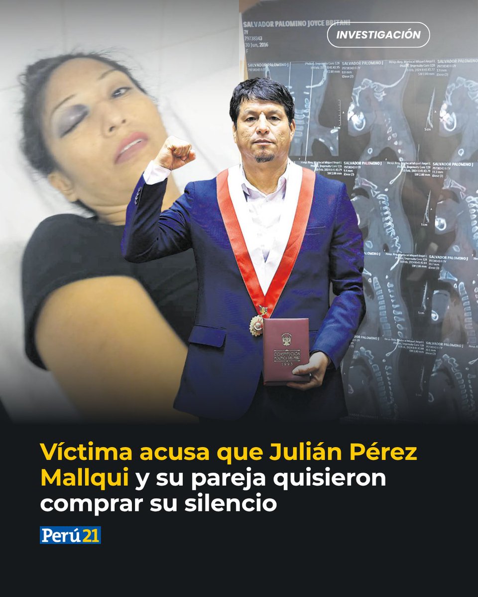 peru21noticias's tweet photo. Llegó al Congreso con Juntos por el Perú pese a estar sentenciado por atropellar a una madre y su hija. Hoy la madre denuncia que le ofreció trabajo para frenar la apelación y que su entonces pareja y abogada, Laura Bonilla, le ofreció S/50,000 para que retirara la denuncia.

Hoy, es Bonilla quien lo acusa de agredirla.

Investigación de Eduardo Quispe

📌 Más información en nuestra web: https://t.co/JUT9GXFW3Z

#JuliánPérezMallqui #Investigación #Política #Congreso #JPP