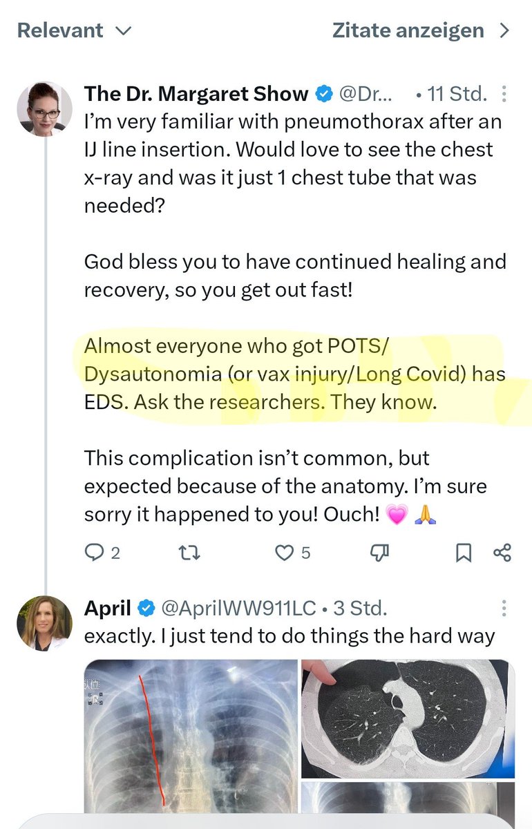 CK65375's tweet photo. Ich folge ja aktuell mehreren Leuten, die wegen #LongCovid und/oder #postvac in Japan sind, um sich dort im Rahmen eines speziellen Protokolls behandeln zu lassen. Eine der Patient*innen ist @AprilWW911LC – an dieser Stelle alles erdenklich Gute an April, die zusätzlich zu ihrer schweren Symptomatik nun auch noch Komplikationen hatte. Sie hat zusätzlich #EDS (Ehlers Danlos Syndrom).
Ich frage mich, wann das in der Forschung endlich eine größere Rolle spielen wird. Bindegewebsstörungen bzw. -Dysfuktionen betreffen so viele mit #MEcfs #LongCovid #Postvac.
Den Fundraiser für April findet ihr hier:
https://t.co/HPvB1EdHjy