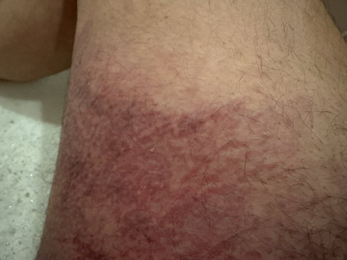 MKierkus's tweet photo. Nikt lekarzowi nie chciał pomóc . 
Zostałem brutalnie pobity przez tych samych ludzi którzy są w układzie Szprotawskim . Pobił mnie Pacjent i Policjant 
Zbigniew Stonoga 6 h po pobiciu był już u mnie 
Nie wszyscy lekarze to oszusci
Jestem lekarzem poz który pracuje w 1 miejscu
@zstonoga2025 @zurnalistapl @portalzeropl