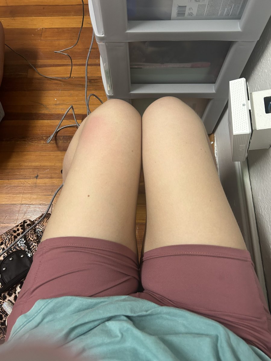ST4RZST4RV3Z's tweet photo. Ugh I need to loose sm more weight
:(
#edrtwtㅤ #hungrytwt #shedrtwt https://t.co/3yrQRFKhEj