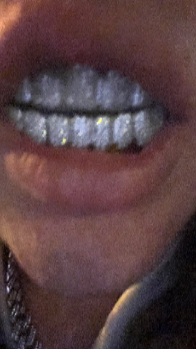 opiumforce's tweet photo. grillz flex https://t.co/4ulkecctrS
