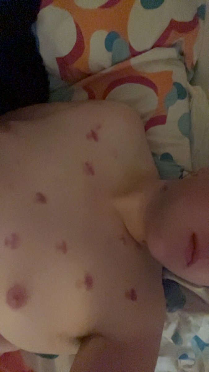 thevessello's tweet photo. Who doesn’t love being all marked up on Sunday 🧛‍♀️🫦 https://t.co/S8ruyEWFuL