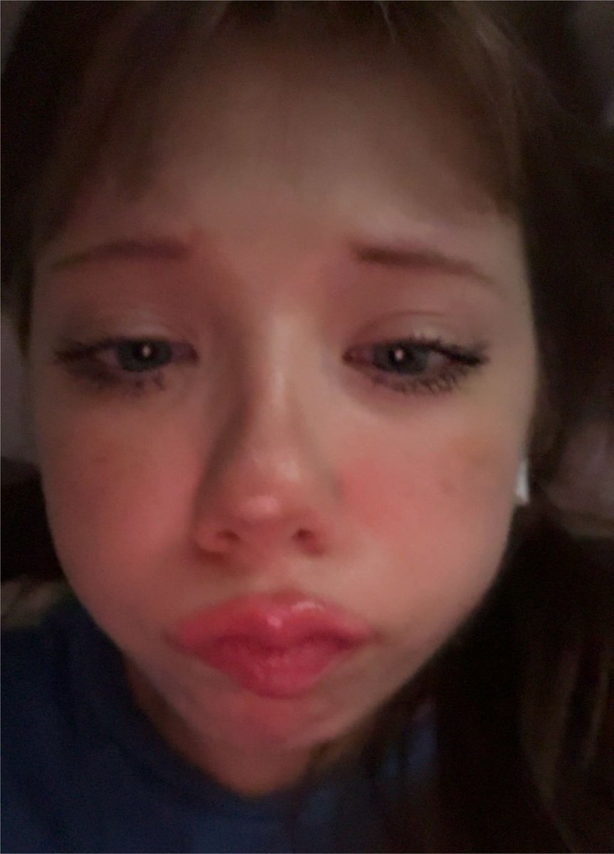 samid0ll's tweet photo. before vs after fancall #chudalert #bedrotting https://t.co/oPN2Z1cUg0