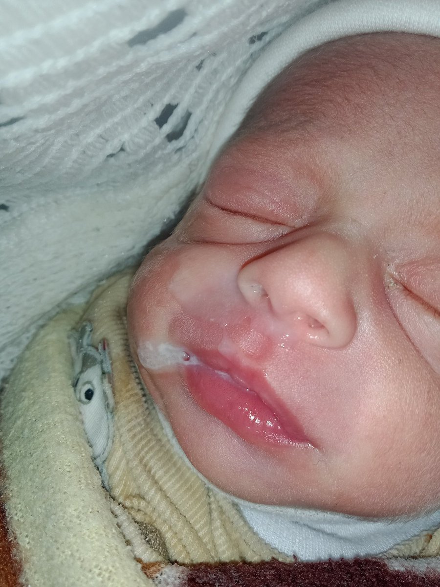 sfyqdl139410's tweet photo. A heartbroken father is pleading with the world for help. His young daughter, who suffers from a heart condition and needs medication she hasn't received for weeks, has been starving for days. Your donation will undoubtedly save her life. 💔😭

Please don't ignore this important matter. Share this post widely. She is a vulnerable little girl. I don't want to lose my daughter.
https://t.co/YyJyPAsVwQ