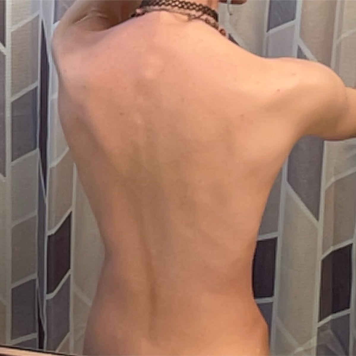 taboofish's tweet photo. 2020-2026. crazy how i look the exact same but so different just bc im older and 10lbs lighter. #edrtwt #bodycheck #shedtwt https://t.co/898aQAZlbC