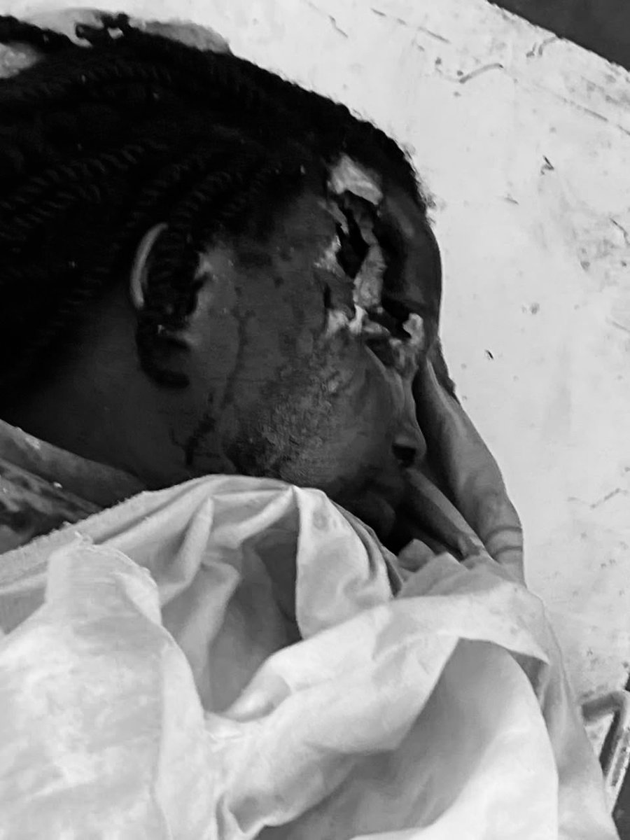 michombero's tweet photo. #RDC : une femme tuée par des hommes armés lors d’une attaque nocturne à Lomera, dans le territoire de Kabare

Une femme a été tuée par balle dans la nuit du 27 au 28 juillet 2026 à Lomera, dans le groupement de Luhihi, en territoire de Kabare (Sud-Kivu), lors d’une attaque attribuée par des témoins à des hommes armés en uniforme dont l’identité n’a pas été établie.

Selon des témoignages recueillis sur place, les assaillants auraient fait irruption dans le secteur à la recherche d’argent, de téléphones portables et d’or. Face à l’absence de biens de valeur, ils auraient ouvert le feu sur la victime à bout portant avant de prendre la fuite.

La victime a été identifiée comme Charlotte Bahati Manegabe, connue de ses proches sous les surnoms de « Dada ». Son décès a suscité une vive émotion au sein de la communauté locale, où les habitants dénoncent la persistance de l’insécurité et la multiplication des attaques contre les civils.

La zone est sous contrôle des rebelles du M23.