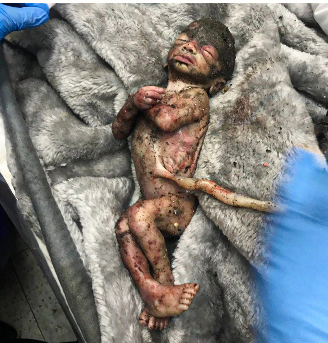 DndTanr1's tweet photo. Gazze'de şehit olmak için illâ doğmuş olmak gerekmez, şehadet her türlü bulur seni... https://t.co/vayGWBaIeS