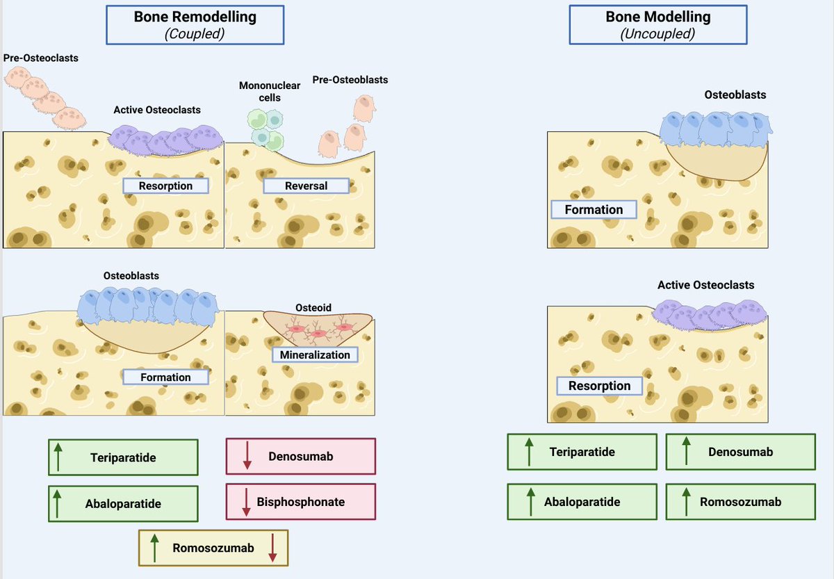 asnpublications's tweet photo. CKD-associated osteoporosis reflects impaired bone quality and turnover, not just low BMD. Diagnosis requires integrating PTH, bone turnover markers, and imaging, while treatment in advanced CKD and transplant recipients remains challenging. https://t.co/2AJHbuCssU #ASNKidney360 https://t.co/oZNIiMVQDk