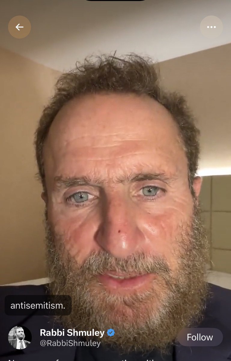 regoledelcapo's tweet photo. Esau/Edomite= Red and Hairy https://t.co/kybXtFGFdJ