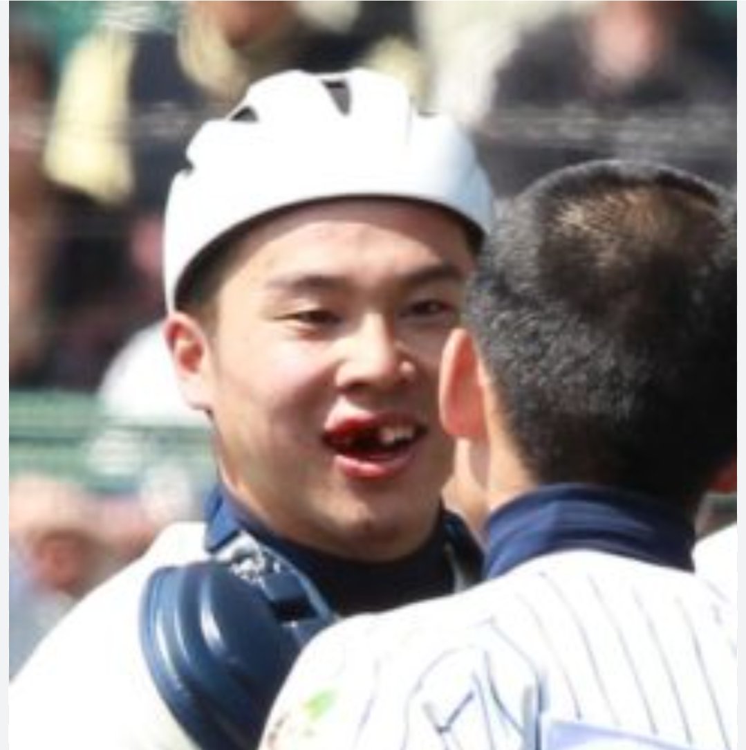 tOyGU2vrm673963's tweet photo. 吉永健太朗を見て、あの夏2011日大三高優勝メンバーを思い出す。

個人的には歴代甲子園優勝チームの中でもTOPクラスに強いチームだったと思う。

動画に出てくる魔球シンカーの吉永、その後プロに進んで活躍した高山や横尾はもちろんのこと

・独特の笑ってるように見える表情から強烈なホームランを放つ、通称「ニヤニヤ王子」の菅沼

・バックホームのボールがイレギュラーして顔面に当たり、前歯がなくなったのにすぐ試合に戻ってくるド根性キャッチャー鈴木

などなど、本当にタレントに富んでいた