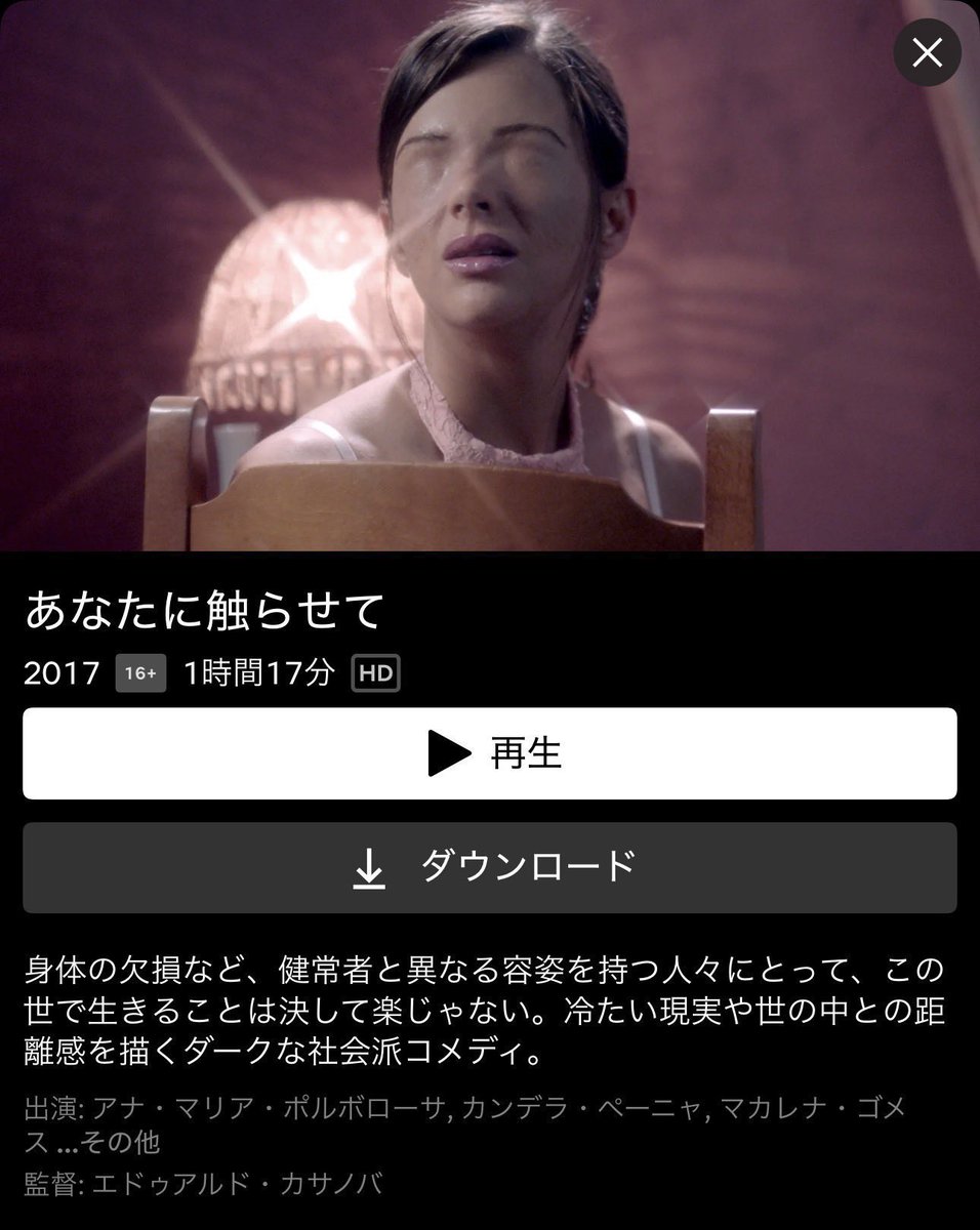 YUI3MOV's tweet photo. ネトフリ民これガチで衝撃的だから見てみて

口と肛門の位置が逆転した女性や、人魚に憧れて両足の切断を望む男性などなど、身体的特徴を持った人たちを描いた異色すぎるダークコメディ🍬

「自分には全く関係ない異世界の話」に思えるかもですが、例えば頭頸部がんに罹患すれば誰しも顔の一部を失ったり、変形が生じたりする可能性がある訳でして。

ルッキズム含め、現実と地続きのテーマ設計に思いのほか“見て良かった”と思えるはず！♡