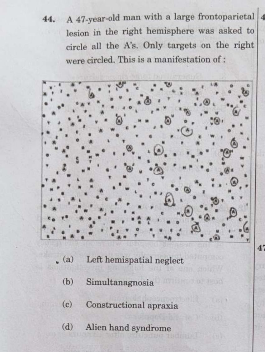 sau_sarup's tweet photo. #upsccms
Image base question paper 1 https://t.co/MpxZVGhlUt