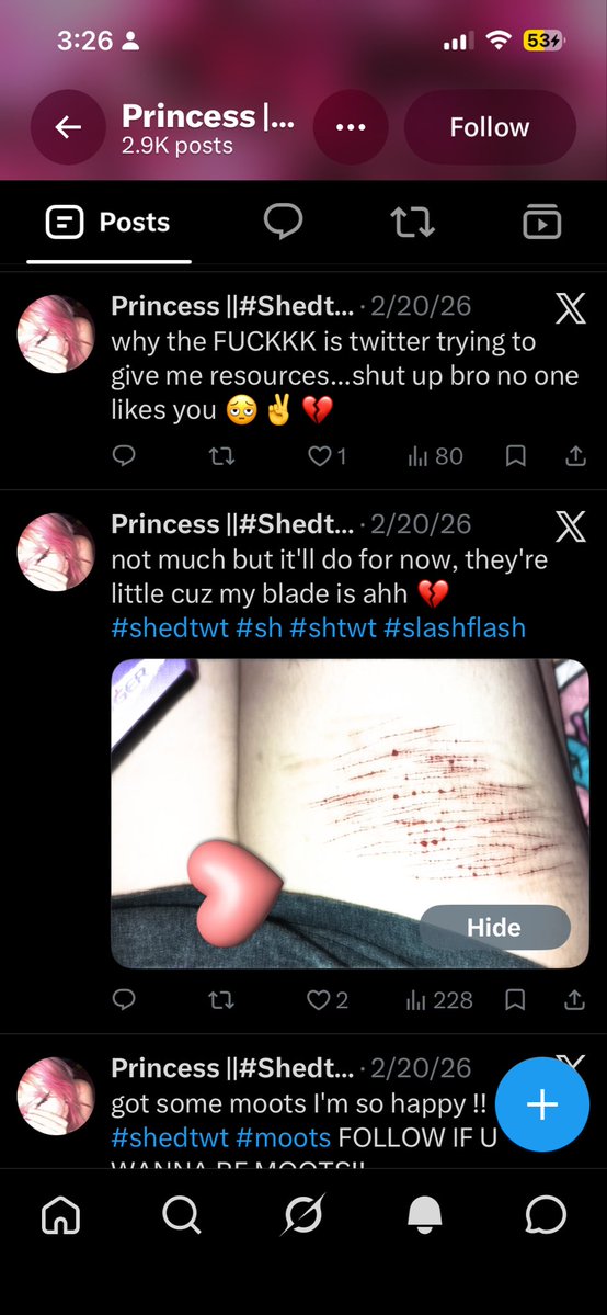 Imnoone_Iyo's tweet photo. @sunbunbby @Elyra_IsGone @lipglossh0ney You might as well chop your legs off at this point 😲😲🤣🤣😭😭😭 https://t.co/WfyxCZtlRa