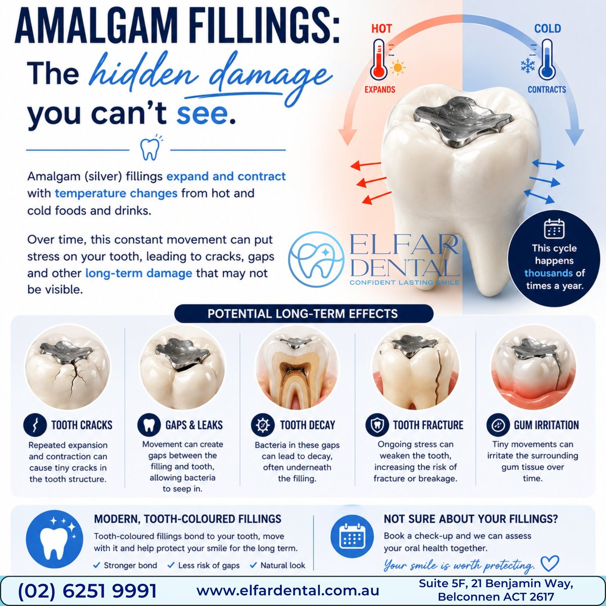 ElfarDental's tweet photo. 🦷 What's hiding beneath an old silver filling?

Many people still have amalgam (silver) fillings that have been serving them well for years. While they can be a durable restorative material, they don't last forever.

(02) 6251 9991
https://t.co/2fcrCvmgp5

#AmalgamFillings https://t.co/BT0nmPFzsP