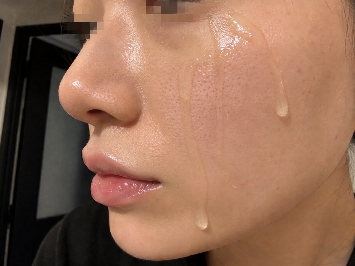 Esp_Heisenberg's tweet photo. Twitterで「ﾎﾟﾂﾎﾟﾂ毛穴にはこれ」ってみんな言ってるから、試しに買ってみたんだが…心底裏切られた。だって… https://t.co/hgvAVzvCxs