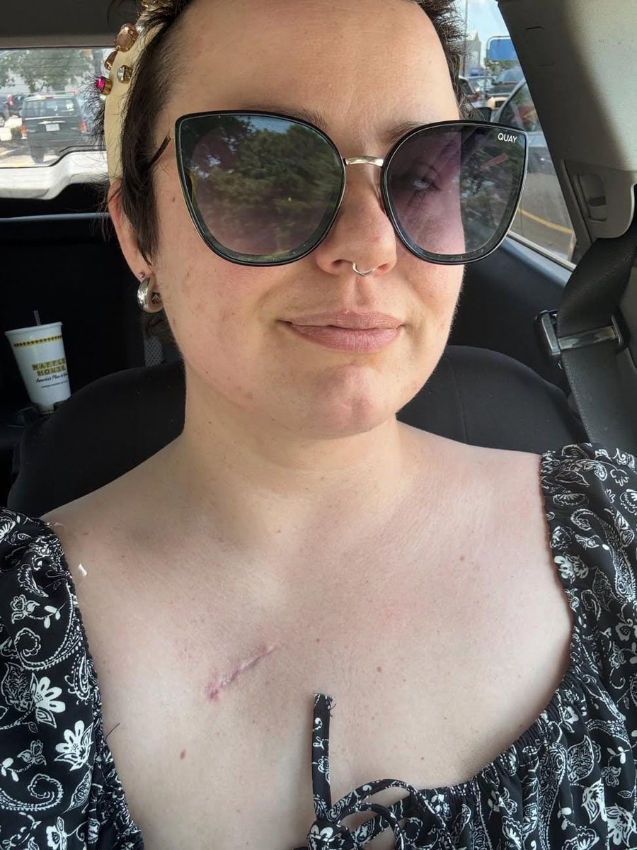 zaracayt's tweet photo. I’m  officially cancer free !!!☺️ 🥹🥲 https://t.co/4mRcJ3s63N
