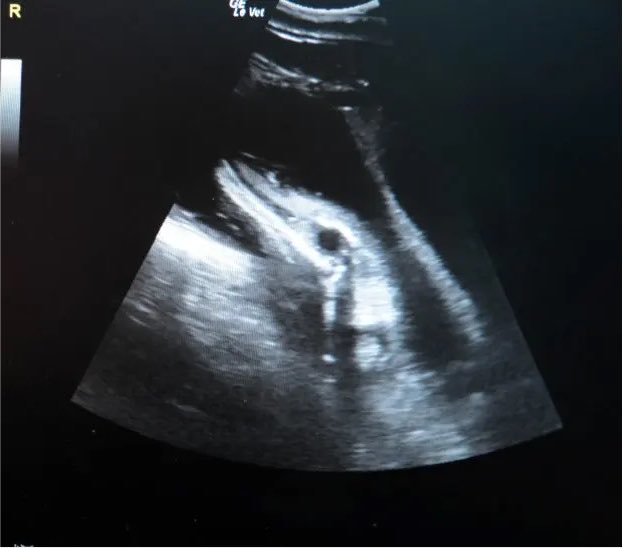 MegamindBuff's tweet photo. I know @ConDawg45 wanted to wait for this big announcement… but I can’t keep this in any longer. After 5 long grueling months of trying for a baby, we are finnaly expecting our first😄🥰🤞 https://t.co/qWj0oS06lU
