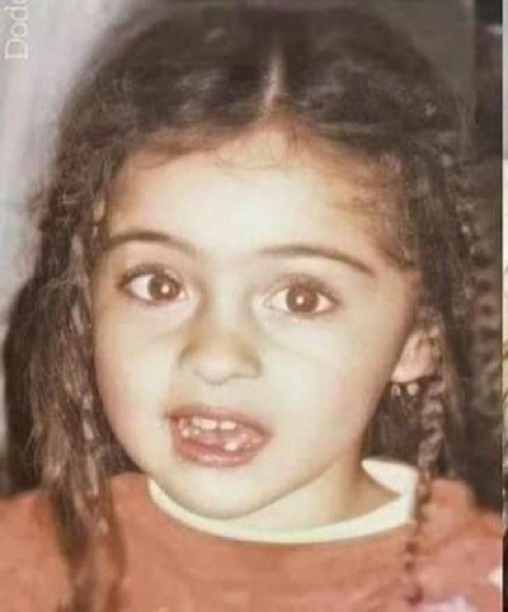 cemrossbays's tweet photo. Mini Cemre                                      Cemre now
#CemreBaysel https://t.co/etrnkiNlF9