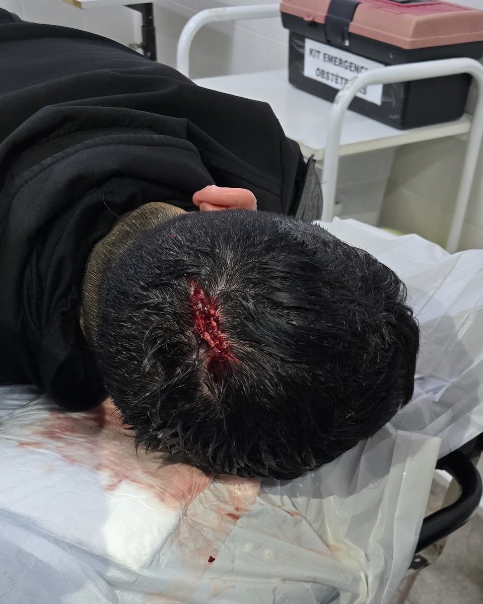 PoliciaCbaOf's tweet photo. ¡Feroz ataque a policías! detenidos tras un violento episodio

✅ Tres hombres terminaron arrestados por agredir a policías durante un procedimiento en San Francisco

🏍️ El episodio se inició cuando un motociclista intentó evadir un control policial y se refugió en una vivienda.

👮🏻 Minutos más tarde, tres sujetos salieron y atacaron al personal sin mediar palabra. Tras disuadir la situación, los efectivos lograron aprehender a los agresores.

🚔 Durante el procedimiento, se secuestró una moto, una tijera y varios elementos de hierro.

🚑 Por otra parte, los uniformados lesionados recibieron asistencia de un servicio de emergencias y fueron trasladados al hospital local con politraumatismo.