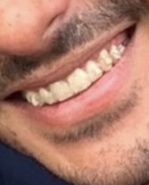 furbas10's tweet photo. โผ๏ธโ ๏ธ
It's been years since he doesn't brush his teeth ๐คข๐คฎ๐คข๐คฎ
#itsverygood https://t.co/8ObwO5lCZX