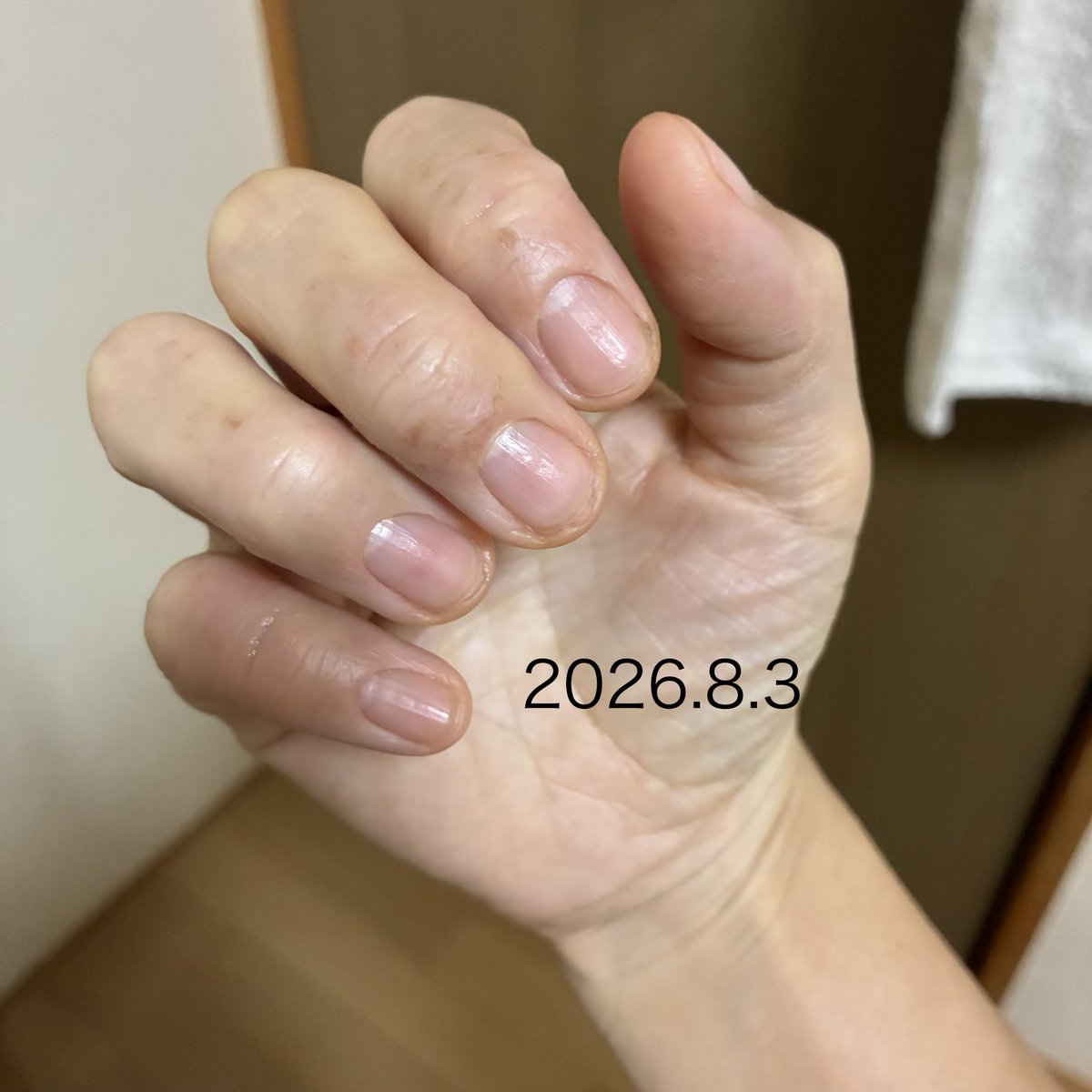 C6cCj's tweet photo. 炎症期から乾燥期に入るまでが長かった
ステロイドはわたしにとって一旦良くなってもじゅくじゅくを助長するだけ😭
絶対に使わない。

デトックスティーと乳酸菌
保湿
暇な時は温泉行くことにして
随分と変わった
じゅくじゅく期はしんどい😢 https://t.co/mqR1WGKUyr
