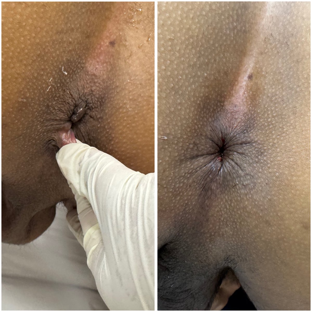 TR_estetica's tweet photo. Um pouco do que rolou na agenda VIP de hoje em São Paulo! 

Muito feliz com os resultados e com a confiança de cada paciente. A estética íntima vai muito além da estética: é saúde, bem-estar, autoestima e qualidade de vida.

Obrigado a todos que fizeram parte de mais essa agenda https://t.co/GMWNpQ1sYy
