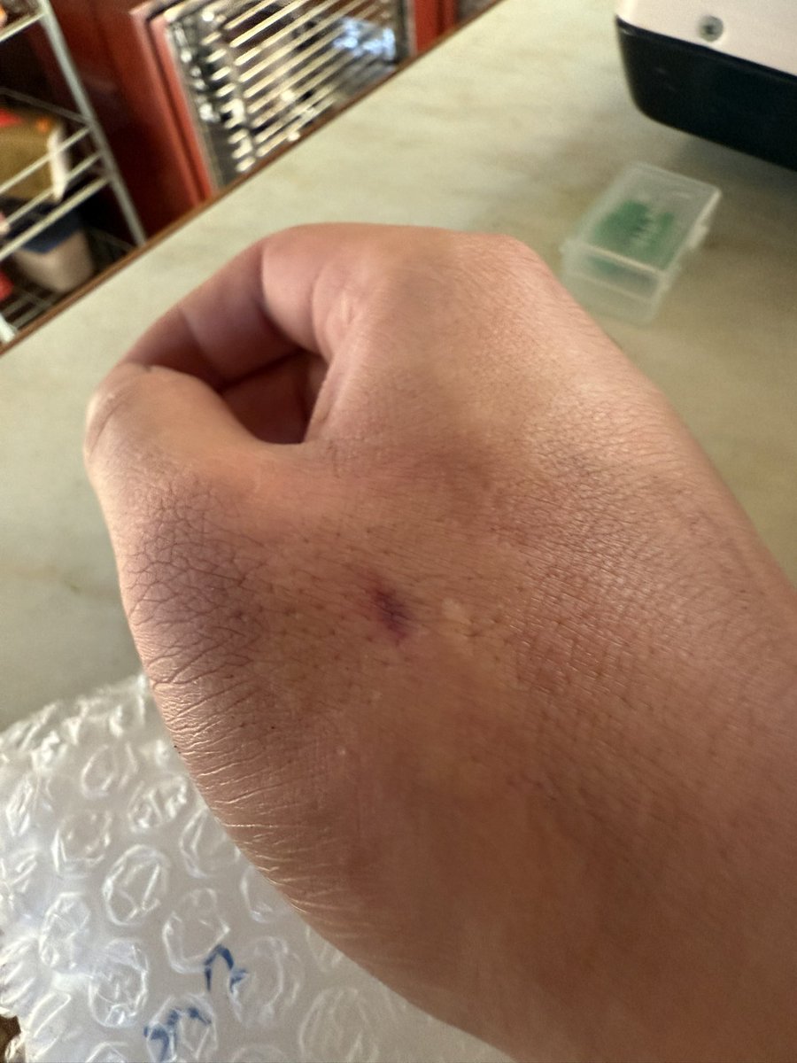 ootaki1001's tweet photo. 朝からアシナガバチに刺された
カイヅカの剪定中に木に絡んだツルを除去しようとしたら🐝
🤷‍♂️ https://t.co/Y9FwqNC9jC