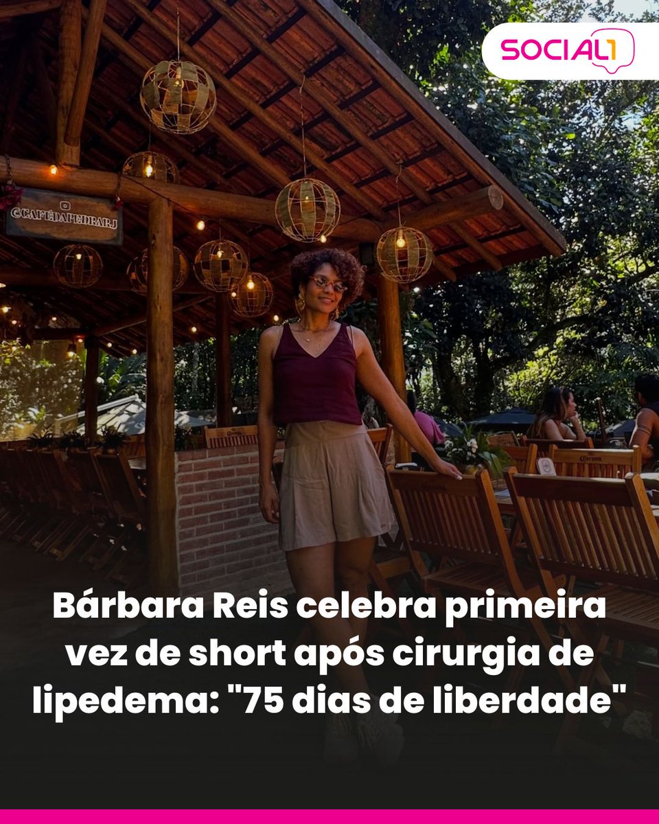 blogsocial1's tweet photo. ✨ Bárbara Reis celebrou um marco na recuperação após a cirurgia de lipedema: pela primeira vez, voltou a usar short e comemorou os "75 dias de liberdade".
📸 Reprodução/ Instagram
#BarbaraReis #Lipedema *co *digital https://t.co/ceR9zoVP8j