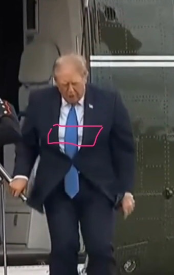 jacquie_rn's tweet photo. See the 2 pics of him from today. He’s wearing a vest under his shirt. It goes directly under his heart. Hooks up to the monitor I’ve been seeing on his waist for a few months now. 
Ur POTUS is wearing an external defibrillator. 
He’s obviously been having arrhythmias 🤨 https://t.co/ilAca8hjsR