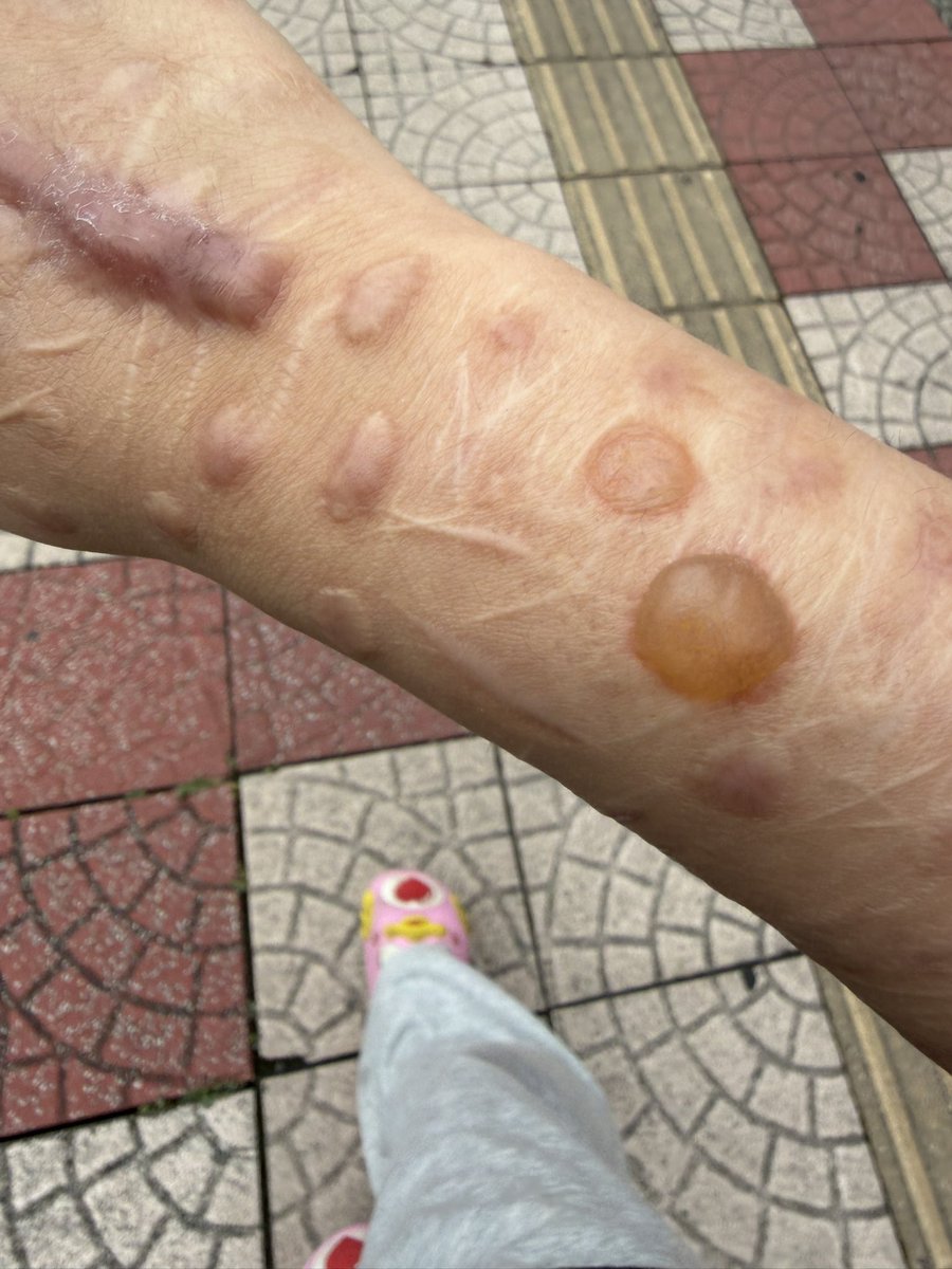 vj8ym's tweet photo. かたきんつぶれた https://t.co/je2s4kAxyS