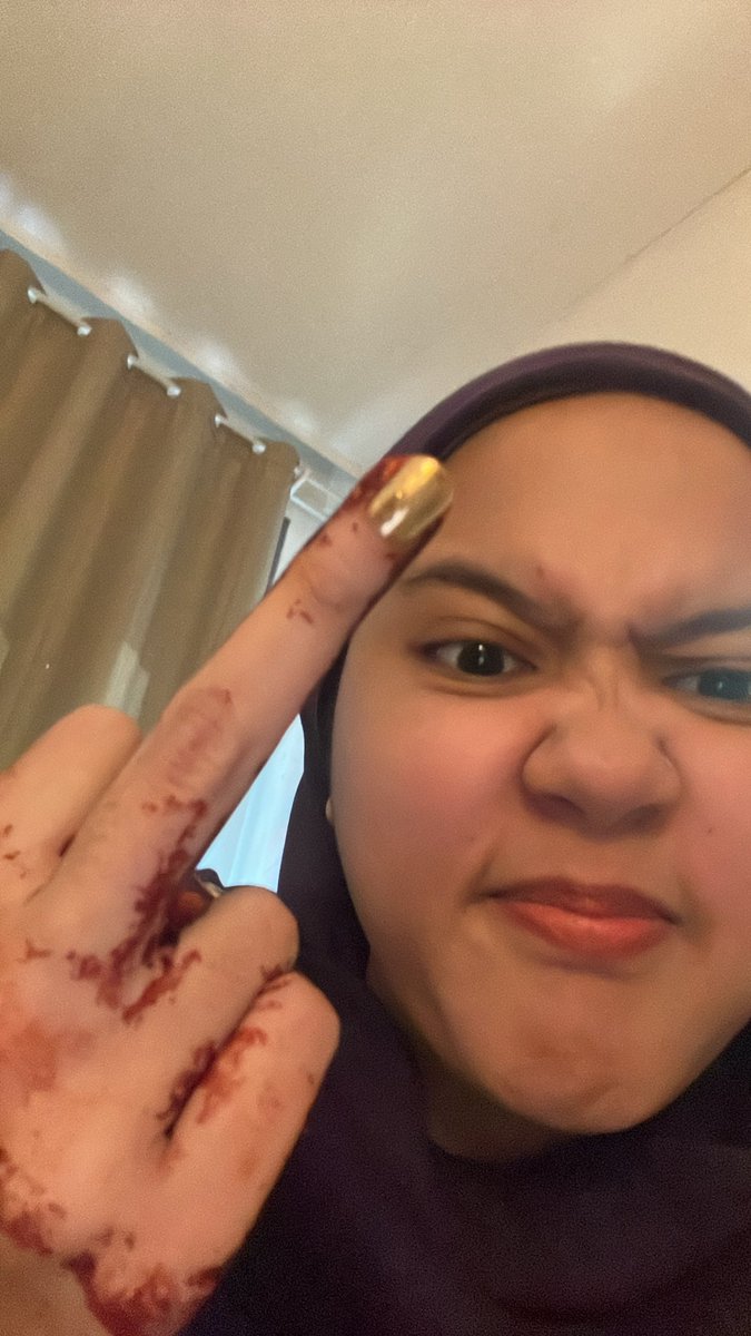 CHUMDOGGG's tweet photo. 🪆took v little pics of my hennas trs 2 hari udh fade???? Ga ngerti ini krn kulit gue kering apa gmn https://t.co/xd6enBD11w
