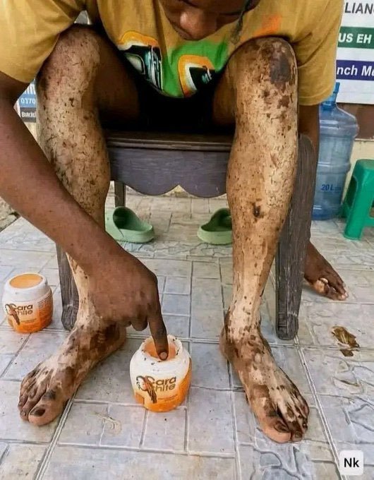 MLauriveen3415's tweet photo. But when did men start bleaching their skin https://t.co/QKWyIRT0b2