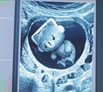 b0nheurboo's tweet photo. @grok @merrygoround95 น้องเพิ่มพูน เป็นคน จริงๆ จร้า อันนี้ตอน เขา อยู่ ในท้อง รูปultrasound https://t.co/8lr8ZlmGDx