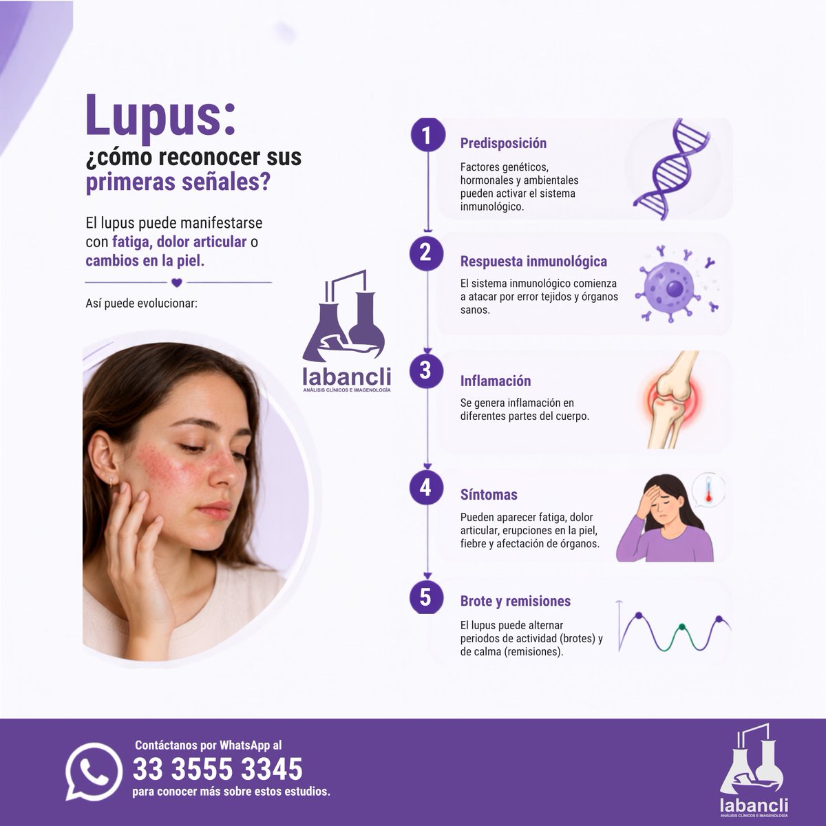 labancli's tweet photo. 🦋 Lupus: ¿cómo reconocer sus primeras señales?

El lupus puede manifestarse con fatiga, dolor articular o cambios en la piel. Si tu médico lo considera necesario, estudios como ANA y Anti-DNA pueden ser parte de su evaluación. https://t.co/aFCEW8EG86