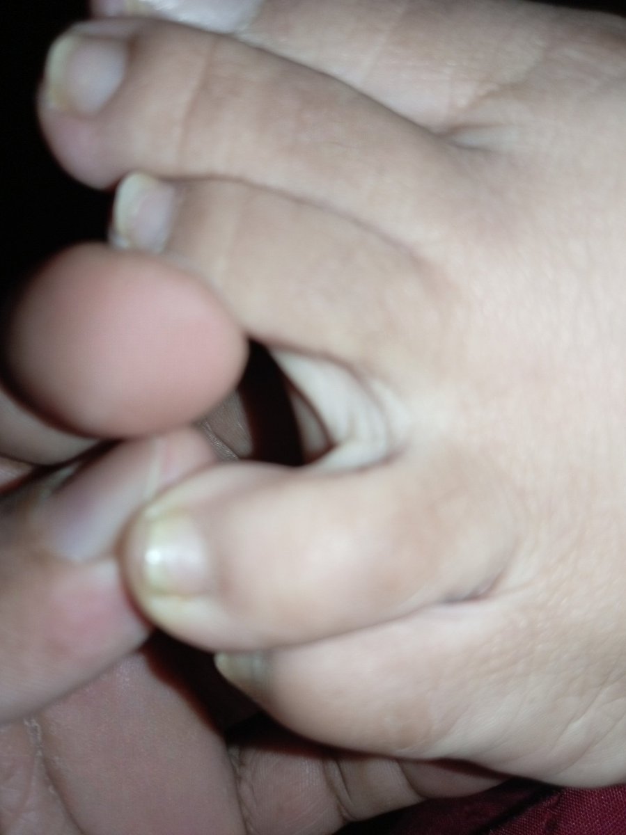 carminafeet12's tweet photo. Para una olfateada antes de dormir! 😷😷👃🏼🧀🤪👃🏼 👣 #pies #piessudados #olor #oloraqueso #piesudados #dedos #dedogordo #deditos #footfetısh #feetfetısh #natural #foot #closeup #soles #plantadelospies #plantas #arrugas #dedosapretados #fetiche #fetichistas #fetichedepies #uñas https://t.co/78r7uVeaYc