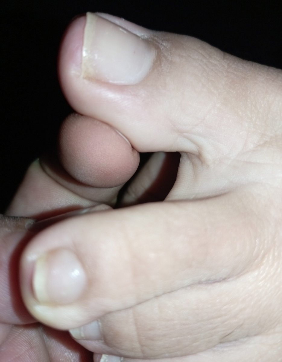 carminafeet12's tweet photo. Para una olfateada antes de dormir! 😷😷👃🏼🧀🤪👃🏼 👣 #pies #piessudados #olor #oloraqueso #piesudados #dedos #dedogordo #deditos #footfetısh #feetfetısh #natural #foot #closeup #soles #plantadelospies #plantas #arrugas #dedosapretados #fetiche #fetichistas #fetichedepies #uñas https://t.co/78r7uVeaYc