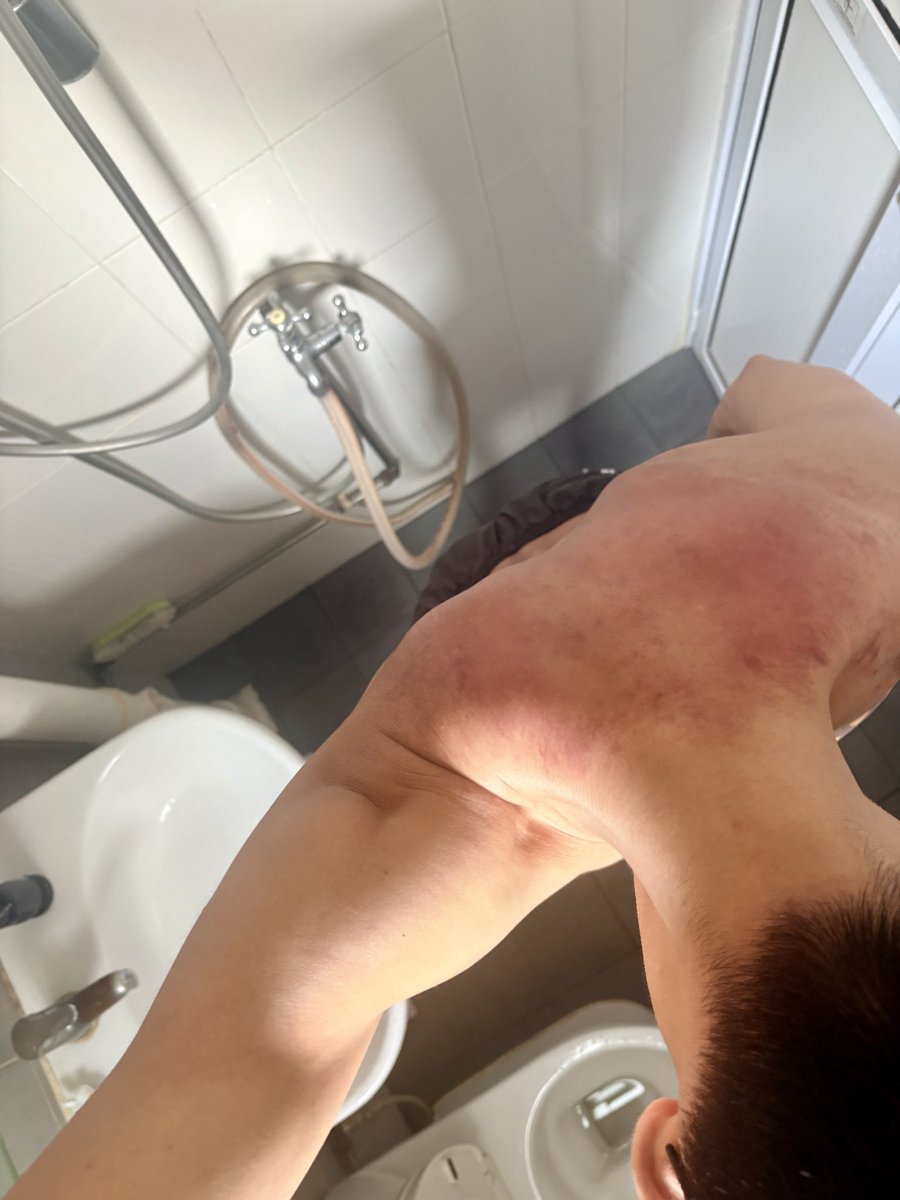 Pup_Zan's tweet photo. Tanked so much flogging at 5idesSG till it still hurts today. I had to ask for it 😜 https://t.co/Lb4sPoNoTz