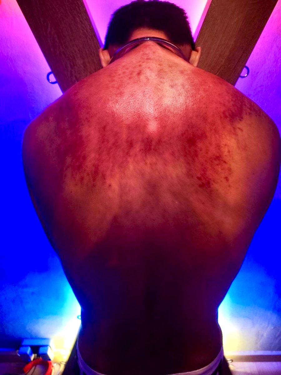Pup_Zan's tweet photo. Tanked so much flogging at 5idesSG till it still hurts today. I had to ask for it 😜 https://t.co/Lb4sPoNoTz