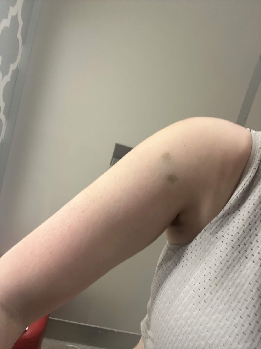 puunk_giirl's tweet photo. oomf just wanted to show me a bruise but ohmygod hes actually #thinspo https://t.co/AiYSCQHAAs