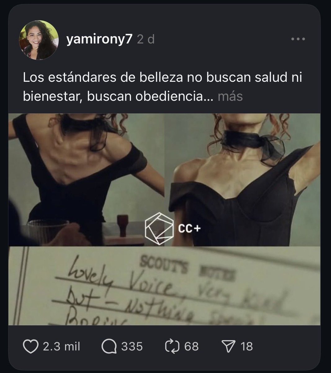 Psicobetza's tweet photo. Sigan diciendo que todo está bien! 😡 Que “hay que ser delgadas ‘por salud’ que “no es tendencia general”. Cuando esto se ve a diario, como cualquier cosa, se crea un estándar que daña profundamente la percepción de salud y normalidad. 
Las celebridades tienen responsabilidad! https://t.co/AnITYd6hyQ