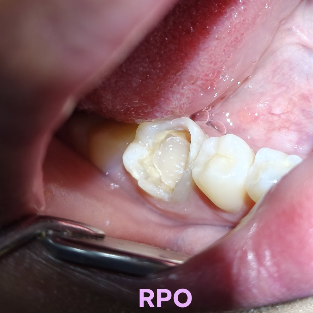 🦷Rakai🪥Virtual Dentist tweet media