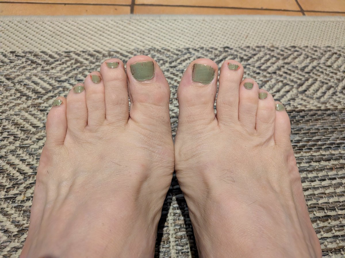 sissydu11's tweet photo. Ce weekend j'ai changé ma couleur et j'ai été profiter de la plage et du soleil ☀️
#valrasplage
#sissy #sissyfeet #footfetish https://t.co/7VnUSpQ0On